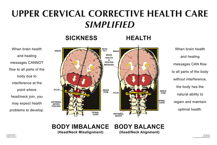 Upper Cervical Chiropractic
